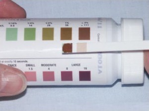 Sugar-testing